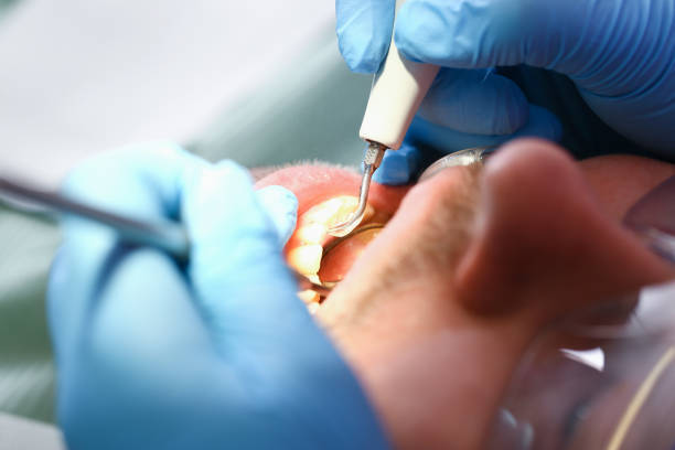 Best Emergency Tooth Extraction  in Whiting, WI