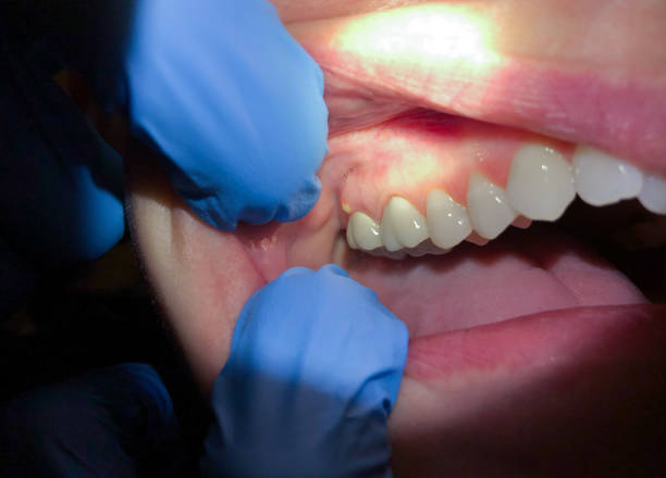 Best Broken Tooth Emergency  in Whiting, WI